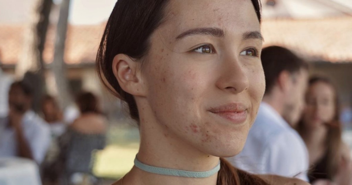 Il Cat Calling che divide