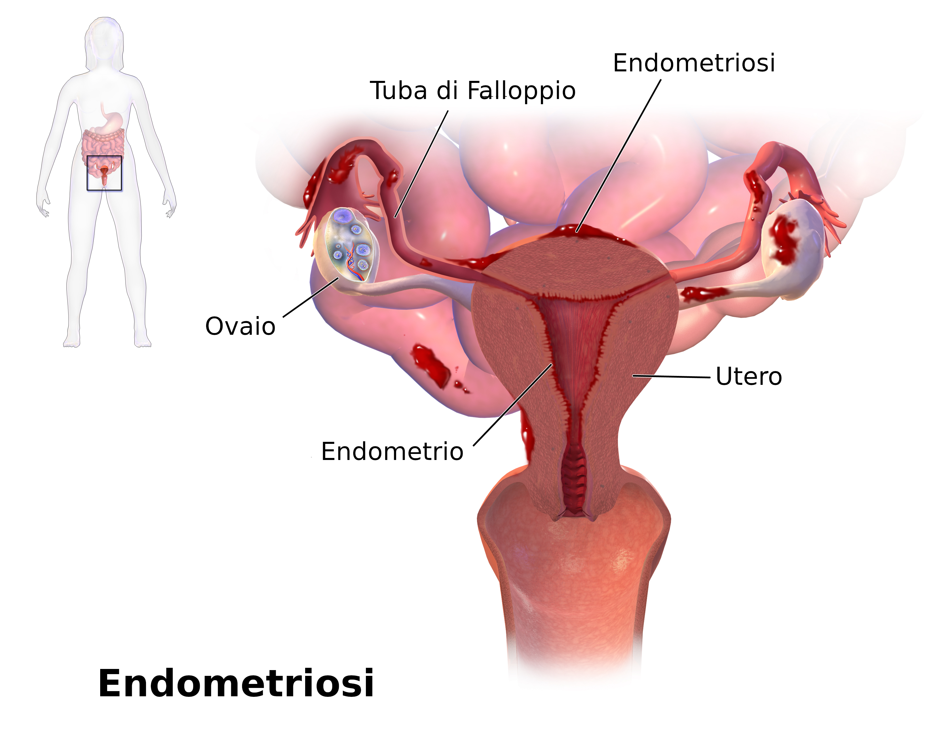 A Trapani e Castellammare iniziative salute su endometriosi e donazione organi