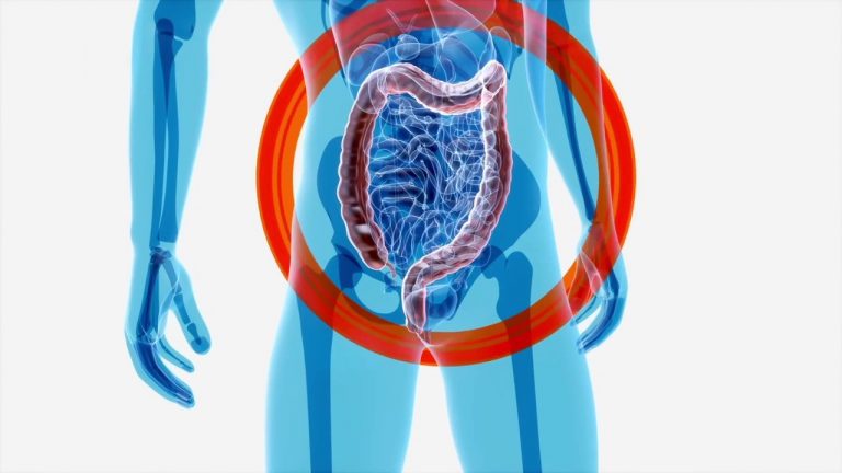Intestino, l’importanza della varietà dei microrganismi
