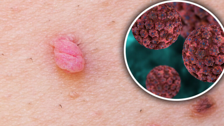 Nei presidi sanitari trapanesi vaccinazione da Papilloma Virus