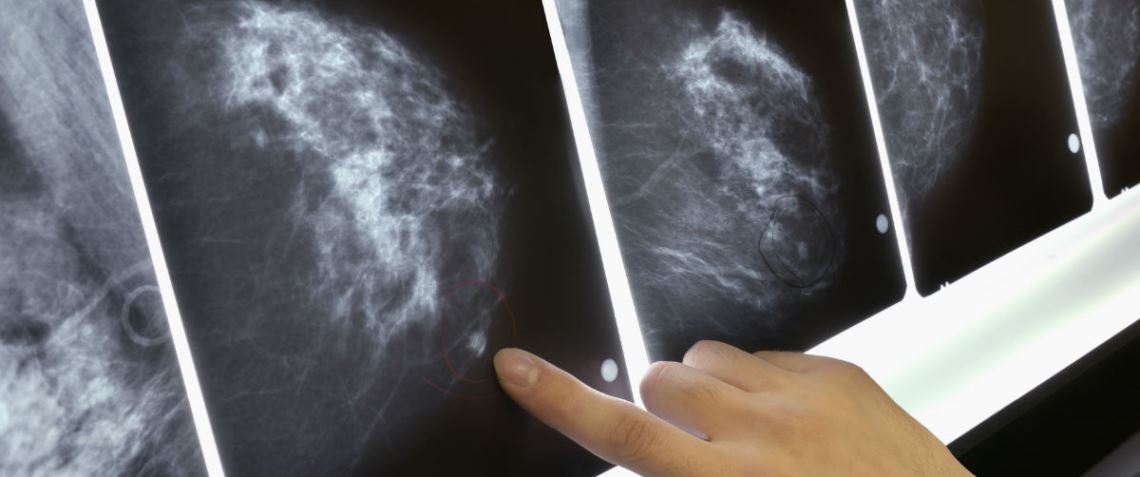 L’Asp di Trapani assicura: “Non ci sono ritardi sui referti delle mammografie e per gli screening del colon retto”
