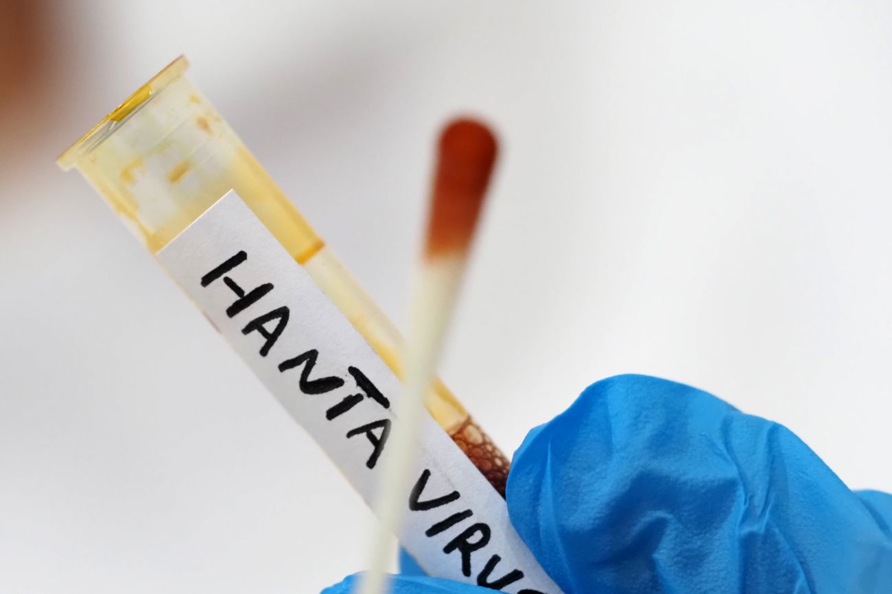 Salute, la Regione siciliana indica i laboratori di riferimento per i test Hantavirus